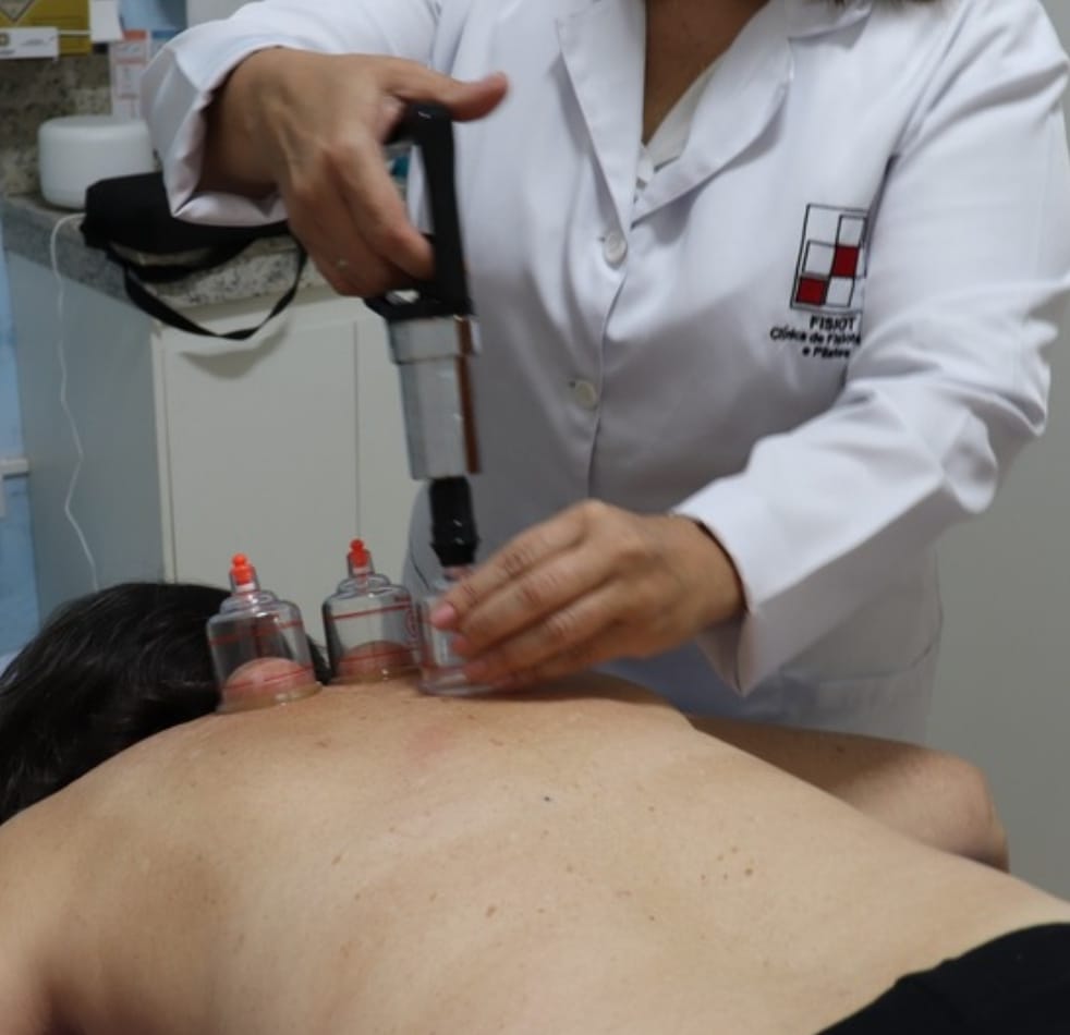 Ventosaterapia Fisiot